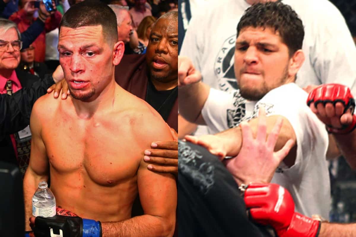 Nick and Nate Diaz after a fight