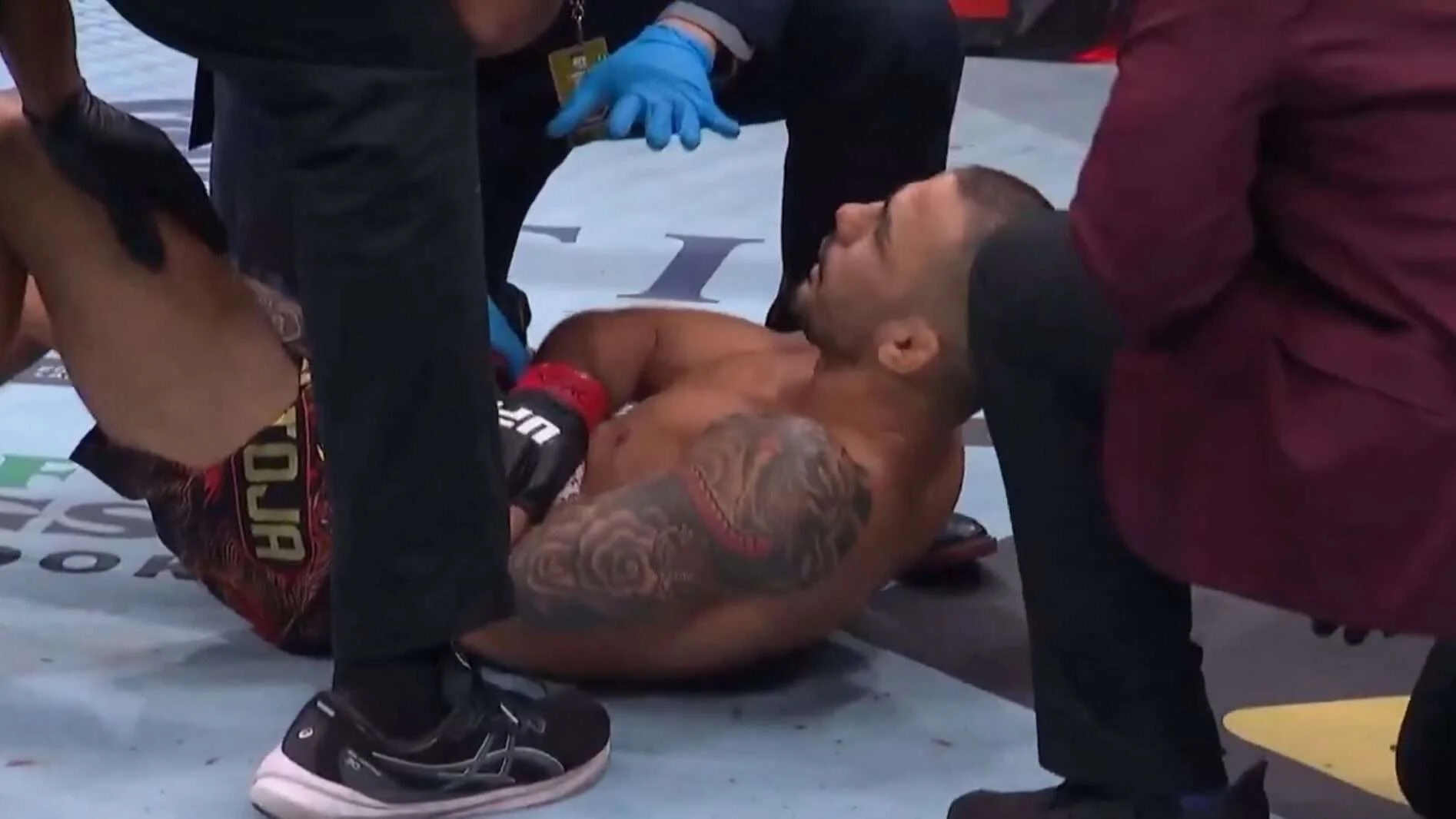 Alexandre Pantoja after the arm injury that cost him the belt at UFC 323