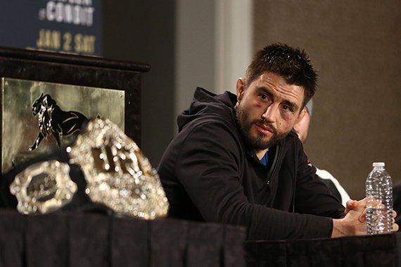 Carlos Condit, bruised under the eye, sits beside the welterweight belt at the UFC 195 post-fight press conference